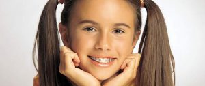 Read more about the article Orthodontics in children and adolescents